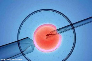 试管代怀生子助孕代妈生殖中心